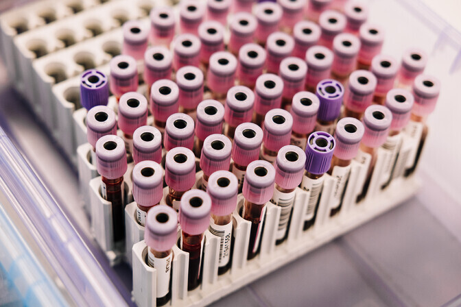 Tartu researchers develop blood test to identify genetic causes of pregnancy loss